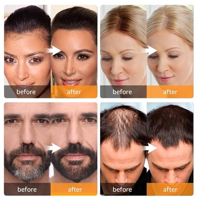 Hairline Powder-2 | Root Cover Up For Effortless Beauty